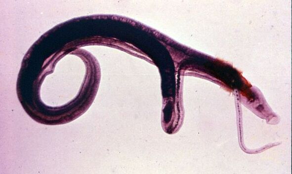 Schistosomy są jednymi z najpowszechniejszych i najniebezpieczniejszych pasożytów